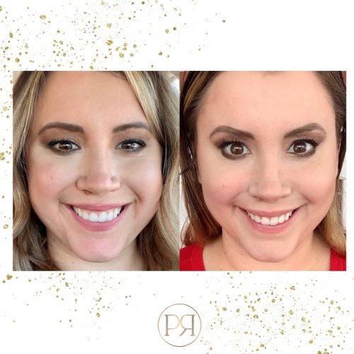 Before And After Eye Refresh